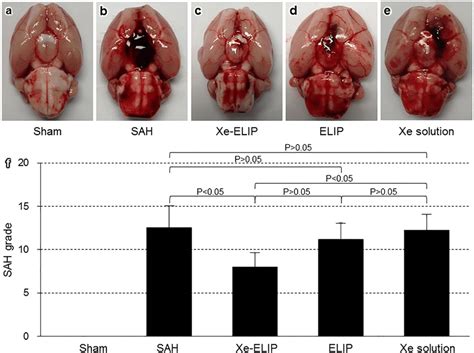 Effect of Xe-ELIP treatment on brain hemorrhage. Gross anatomy of brain ...