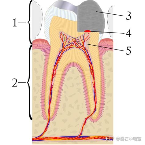 牙髓压盖术 盖髓 Pulp capping - 知乎