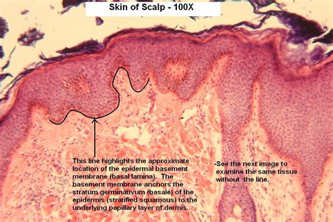 Skin of Scalp – Tutorial – Histology Atlas for Anatomy and Physiology