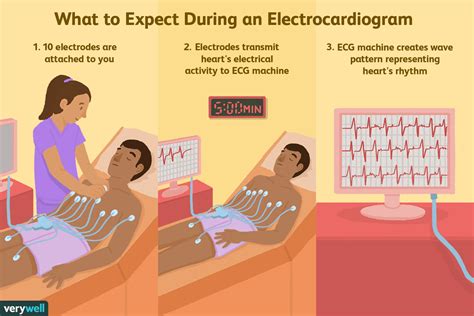 Electrocardiogram (ECG or EKG): Procedure and Results