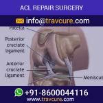 Anterior Cruciate Ligament Surgery Review by Ayub A.