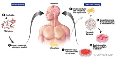 Nanotechnology: Potential options for glioblastoma treatment - Mayo Clinic