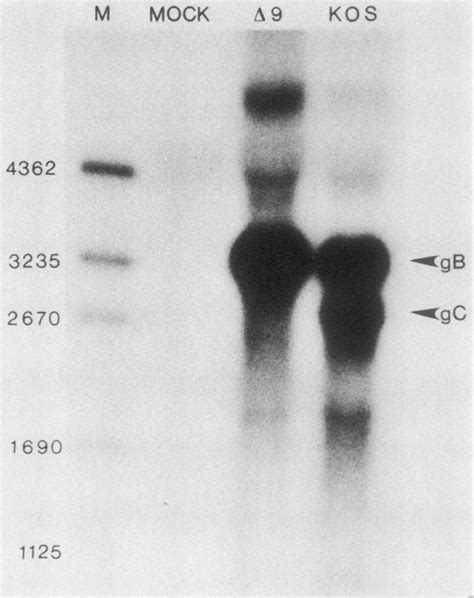 Northern blot hybridization of RNA isolated from wildtype and... | Download Scientific Diagram