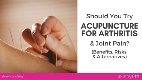 Should You Try Acupuncture For Arthritis & Joint Pain? (Benefits, Risks ...