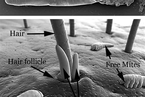 Science Snippet: Skin Mites - Door County Pulse