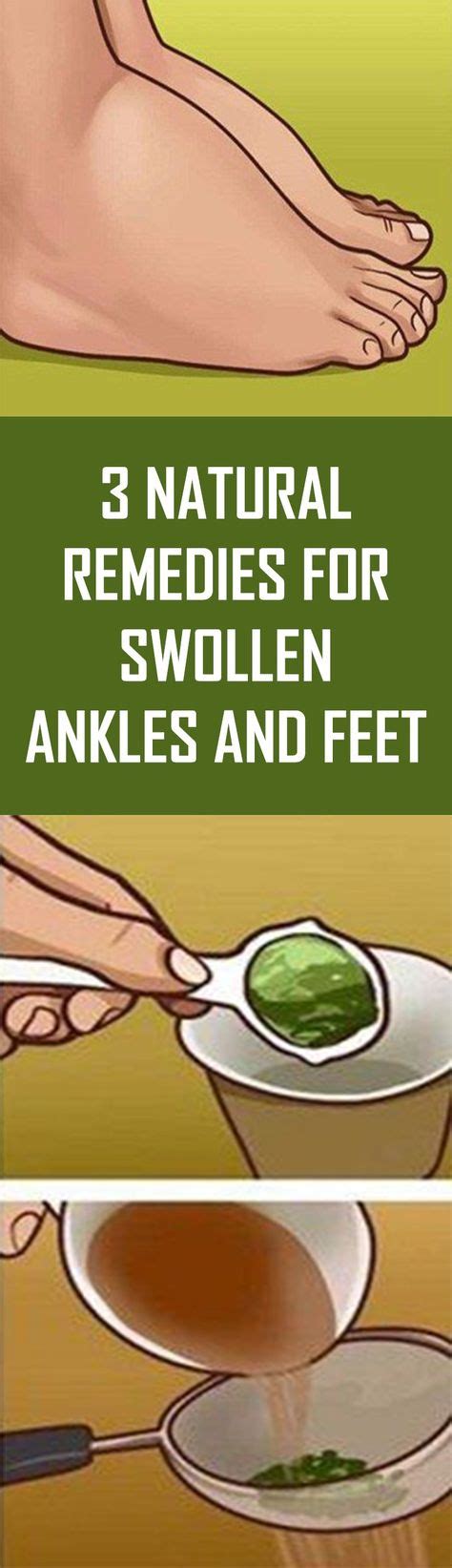 3 Natural Remedies For Swollen Ankles and Feet, #body #Care #feetcare #health #healthy # ...