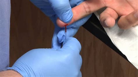 Phlebotomy: Dermal Capillary Punctures | Blood Collection (Rx-TN) - YouTube