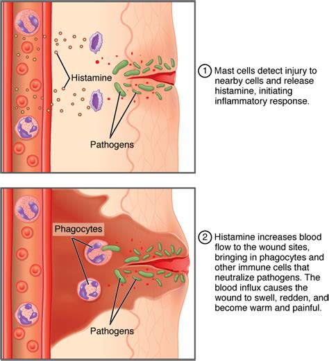 Barrier Defenses and the Innate Immune Response · Anatomy and Physiology