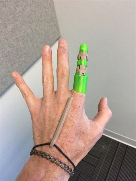 Knick's Prosthetic Finger v3.5.5 by knick - Thingiverse | Prosthetic fingers, Prosthetics, Finger