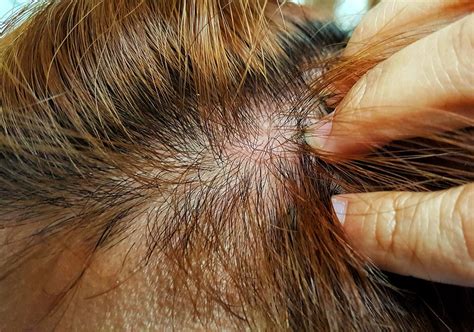 4 Coffee Hair Dye Side Effects You Must Know – HairstyleCamp
