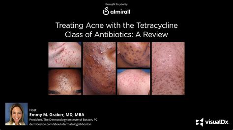 Treating Acne with the Tetracycline Class of Antibiotics: A Review ...