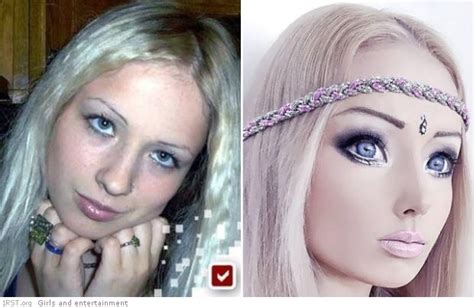 Valeria Lukyanowa - before and after plastic surgery