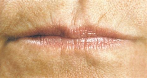 What Causes Wrinkles Around Your Lips | Lipstutorial.org