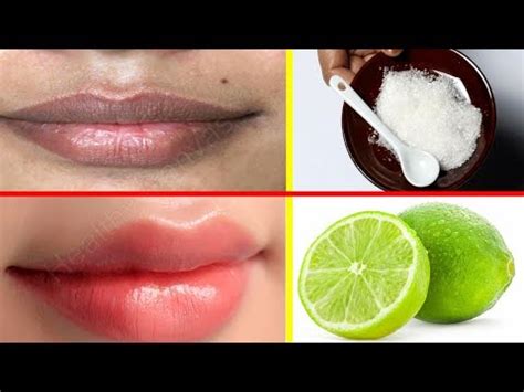 How To Get Baby Soft Pink Lips in Just 3 Day Naturally at Home | Pink ...