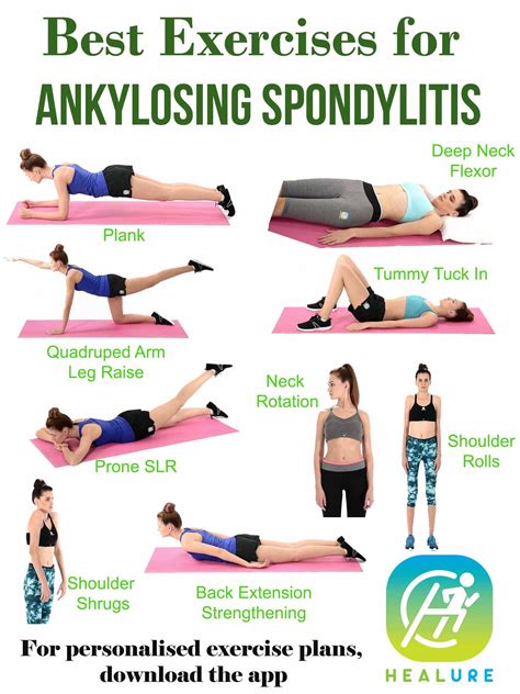 Healure - Best Exercises For Ankylosing Spondylitis...