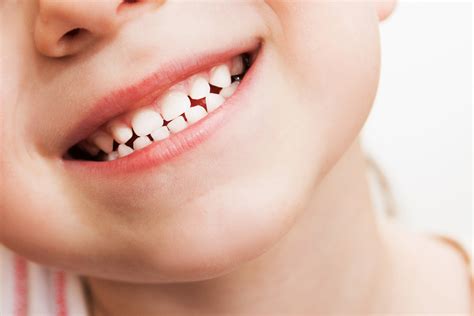 5 Things Parents Should Know about Children’s Teeth