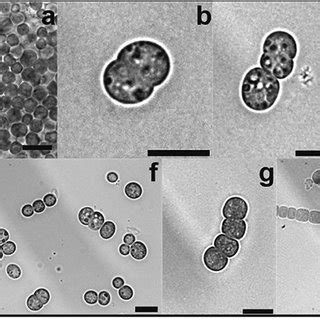 Progress of akinete germination in A. variabilis. Germination of mature... | Download Scientific ...