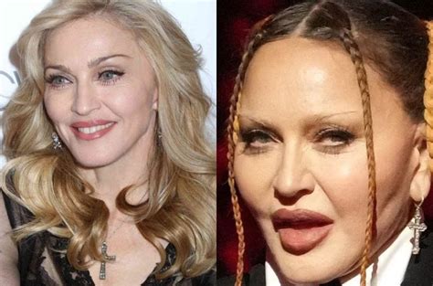 'Looks like it hurts': Madonna's 'new face' shocks fans [photos]