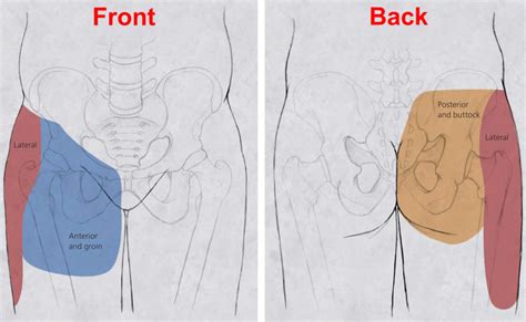 Hip pain causes, hip pain symptoms, diagnosis and hip pain treatment