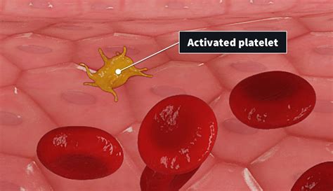 The physiology behind wound healing | Complete Anatomy