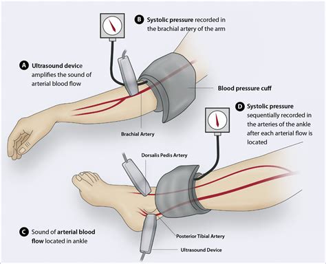 North Jersey Therapy & Diagnostic Centers - ABI Test