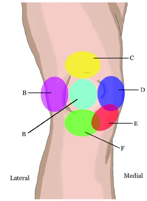 Back Knee Pain Location Chart