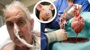 David Bennett world first human receives a Pig Heart Transplant