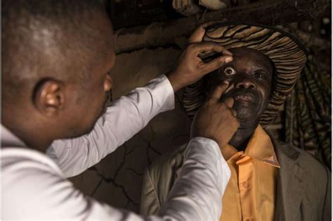 Study shows that African eye worm threatens elimination of river blindness