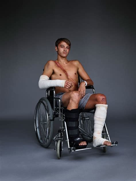 10 Car Crash Survivors Posing For A Shocking Photo Project Aimed To Raise Awareness About ...