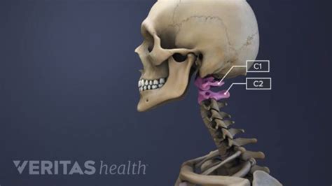 The C1-C2 Vertebrae and Spinal Segment | Spinal, Spinal arthritis ...