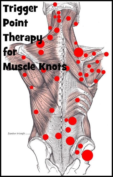 Effective Trigger Point Therapy for Muscle Knots - RemedyGrove ...