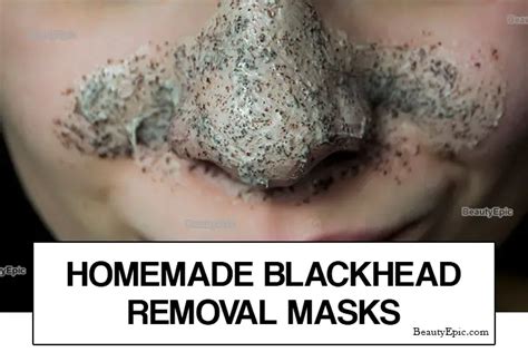 Blackhead Removal Mask: 7 DIY Recipes & Benefits