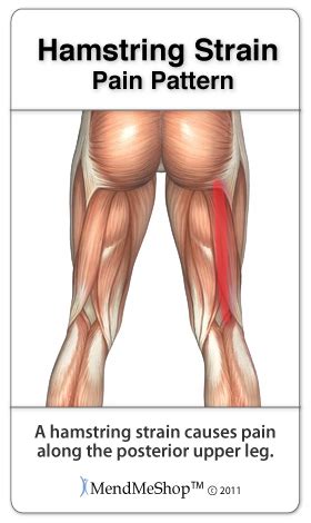 Symptoms of Hamstring Pulls