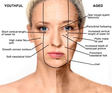 A to Z of Periorbital Injectables: Understanding Anatomy & Complications