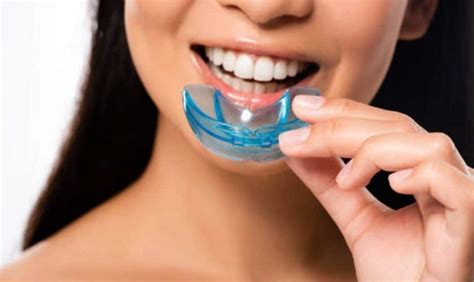 How Are Mouthguards Beneficial For Your Oral Health?