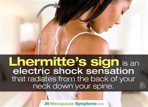 Lhermitte's Sign FAQs | Menopause Now