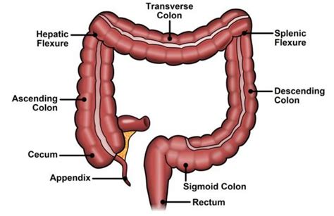 Hereditary Nonpolyposis Colorectal Cancer (HNPCC) - CancerOz