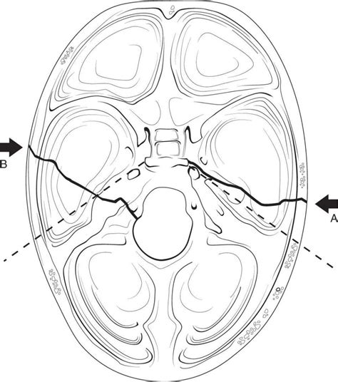 Otolaryngology: Diseases Of The Head And Neck | Basicmedical Key