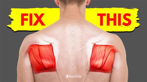 How to Fix Shoulder Blade Pain for Good | SpineCare