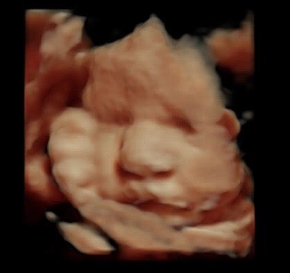 36 Week Ultrasound - Reveal 3D/4D Ultrasound Studio