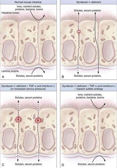 Protein-Losing Gastroenteropathy | Abdominal Key