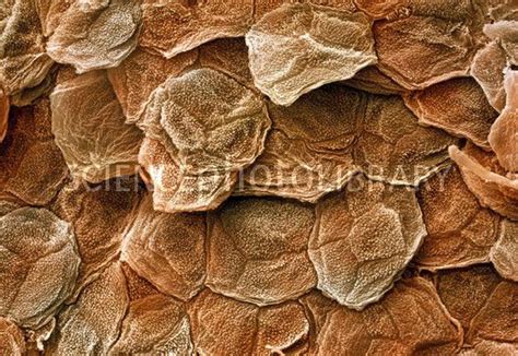 Human skin. Coloured scanning electron micrograph (SEM) of the outermost layer of human skin ...