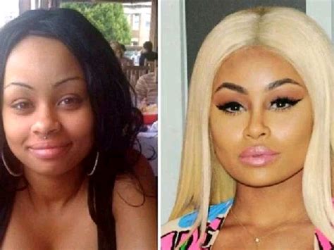 Celebrities Who Bleached Their Skin Before And After Photos | Boombuzz