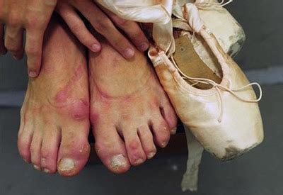 Dancing Shoes - Final Year Film: Research into foot damage from point shoes