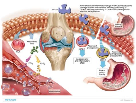 NSAIDs mechanism of action | Pharmacology, Medical illustration, Nursing instructor