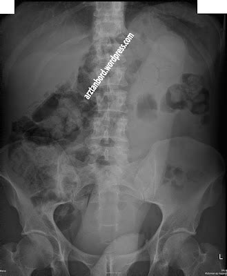 Diagnoserätsel: Spaß mit Folgen | Arzt an Bord