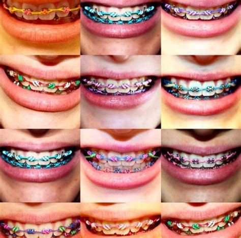 Braces color wheel braces color wheel - happypole