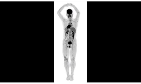 Human images from world's first total-body scanner unveiled