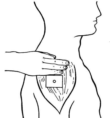 Administer Intramuscular, Subcutaneous, and Intradermal Injections