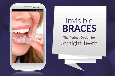 Invisible Braces to Straighten Crowded Teeth - Orthodontics Treatment in UK